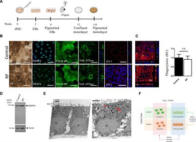 Mutant PRPF8 Causes Widespread Splicing Changes in Spliceosome Components in Retinitis Pigmentosa Patient iPSC-Derived RPE Cells